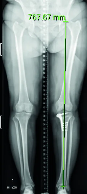 Post op imaging day 1 - 01